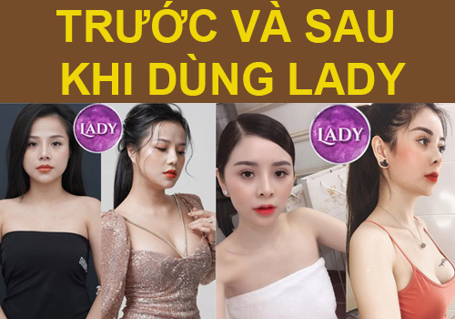 tăng kích thước vòng 1