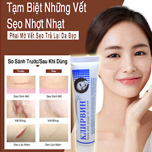 Kem trị sẹo